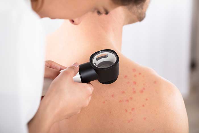 Man getting skin inspected