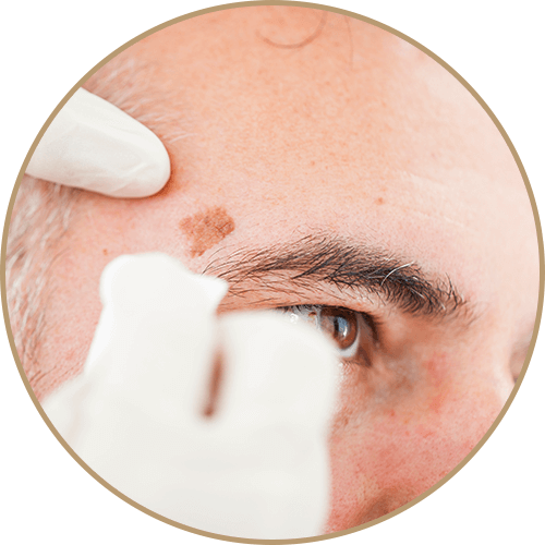 Skin Care Clinic In Fort Collins Loveland Co