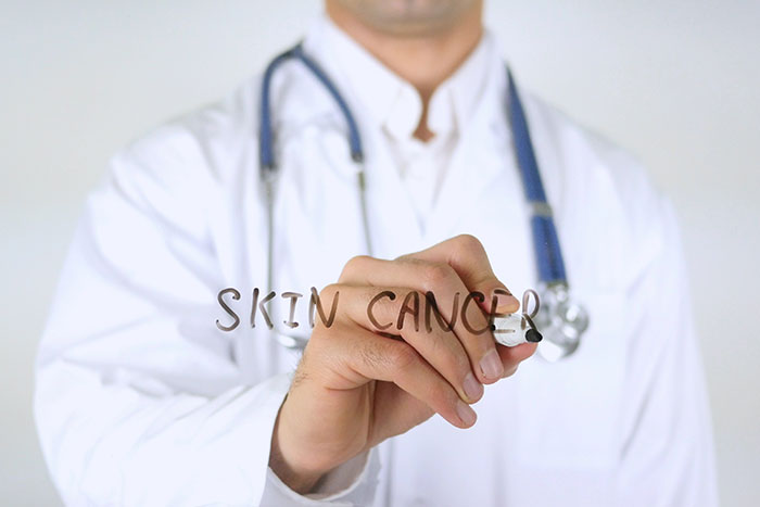 skin cancer treatment in Fort Collins, CO