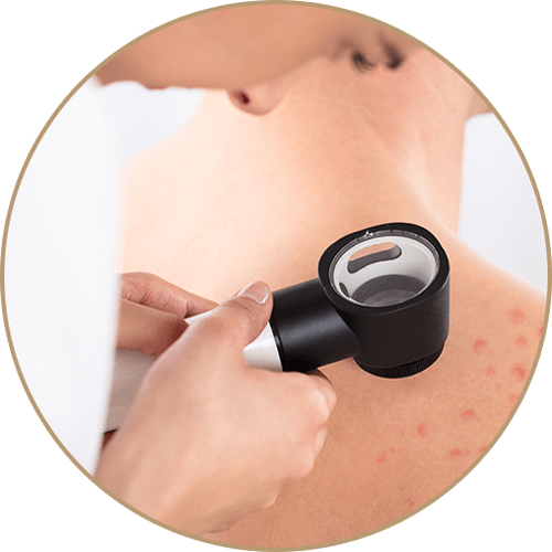 Common Skin Conditions Treatment in Fort Collins, CO