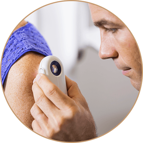 Rare Skin Condition Treatment in Fort Collins & Loveland, CO