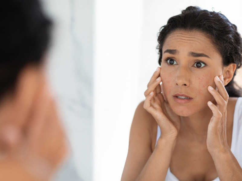 Know if Skin products cause Acne from Divine Dermatology