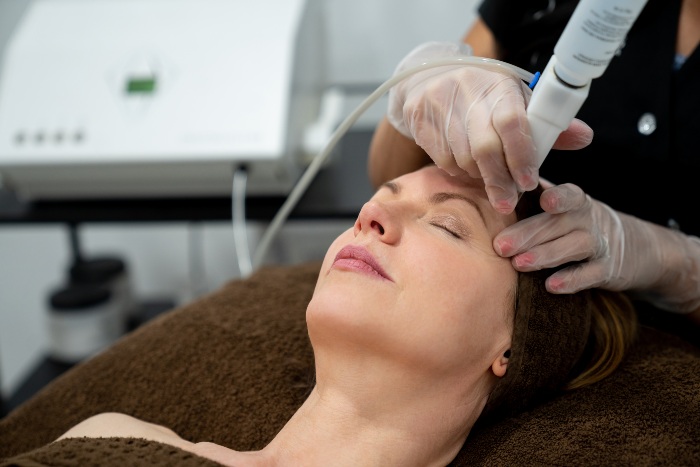 Laser Treatments for the Face in Fort Collins & Loveland, CO