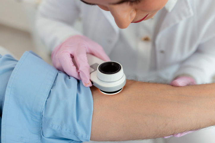 Mohs Surgery for Skin Cancer Treatment in Fort Collins and Loveland, CO