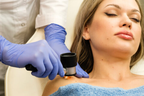 Skin Tag Removal Specialists in Fort Collins and Loveland, CO