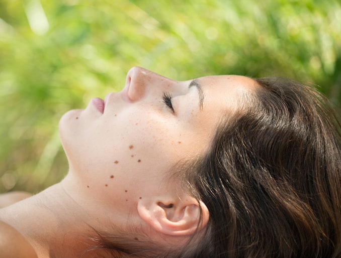 The impact of sun exposure on moles in Fort Collins & Loveland, CO